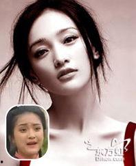 有明星打瘦脸针,揭秘打瘦脸针的神奇效果