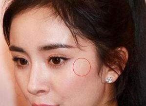 明星无伤疤,揭秘明星无伤疤的美丽秘密